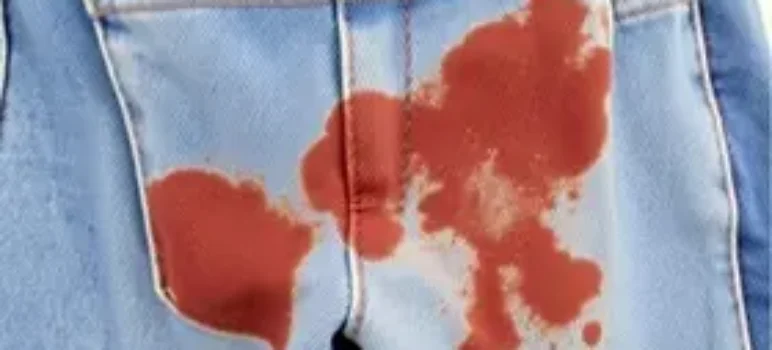 tirar manchas de jeans sem desbotar