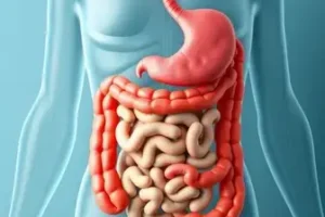 doença inflamatória intestinal