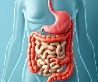 doença inflamatória intestinal
